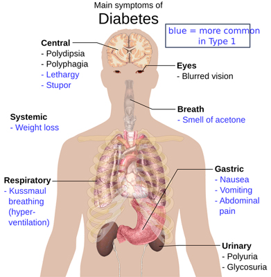 diabete